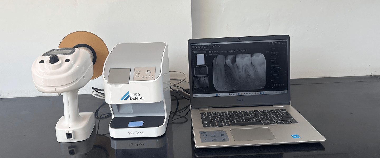 Apollo Dental Jayanagar – Clinic View 2